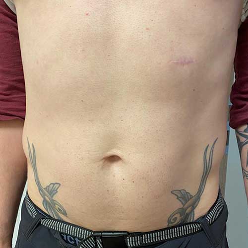 BODYformer bei FIGURline sichtbare Erfolge mit dem BODYformer erzielen